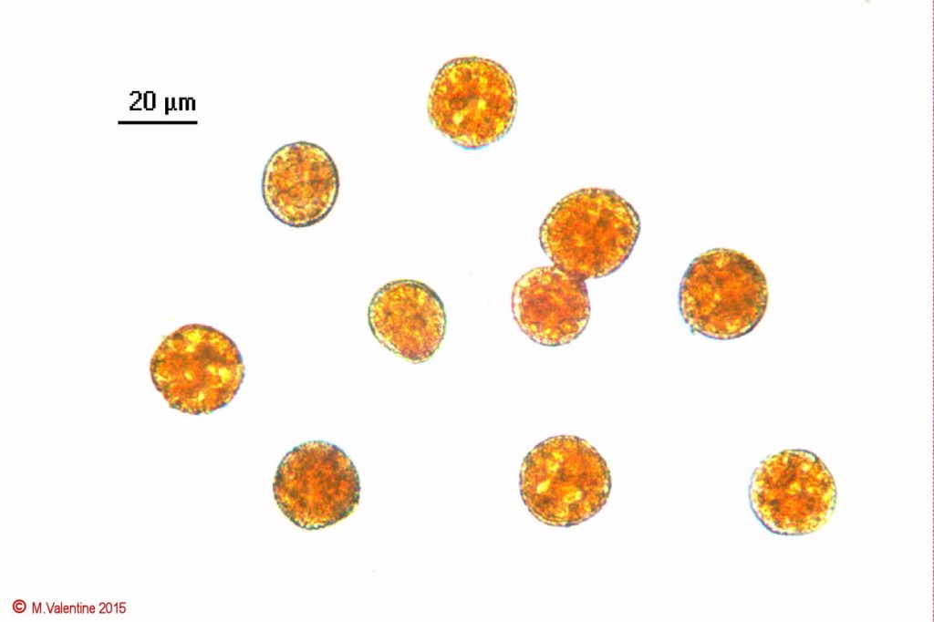 Trachyspora intrusa Spores x400(1) with scale.jpg