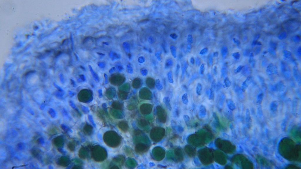 Phgris_upper-cortex_capture000008.jpg
