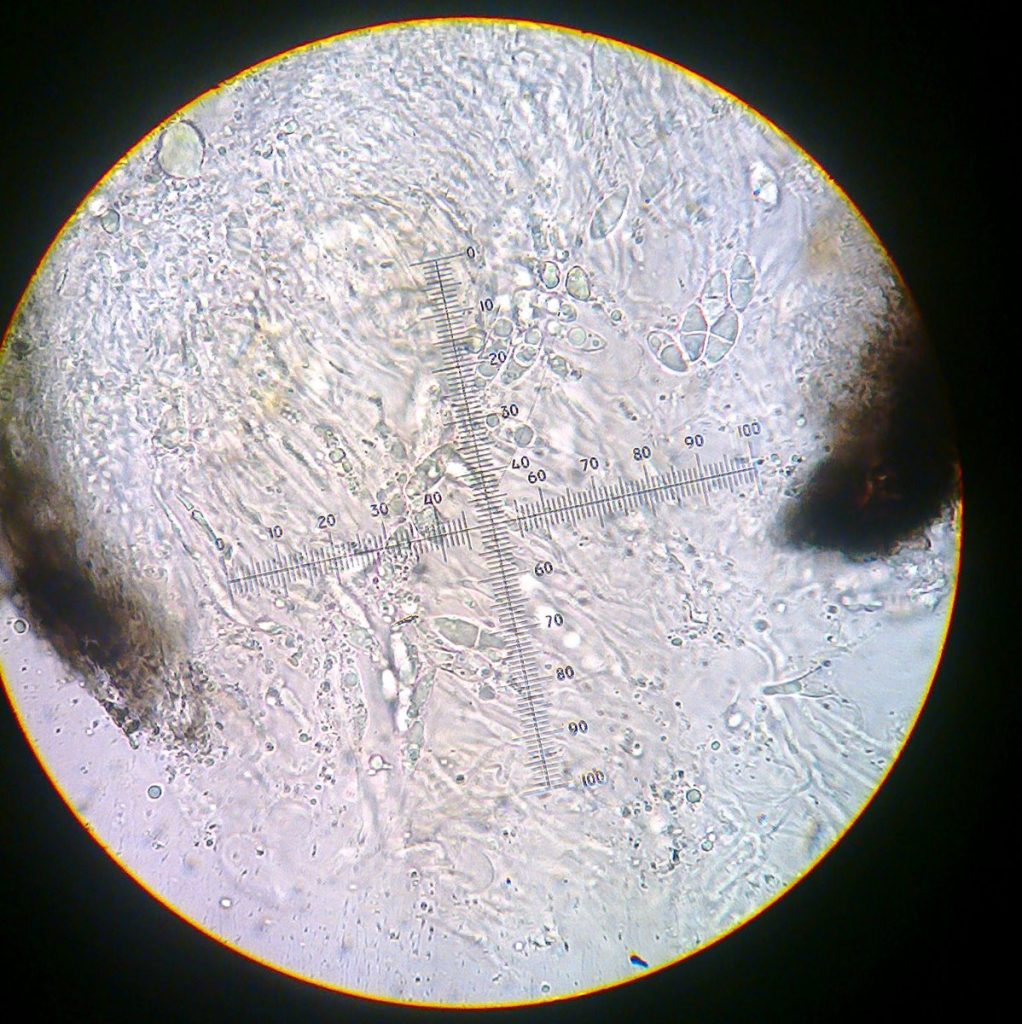Anisomeridium cf. polypori (sporer) 2-3.jpg