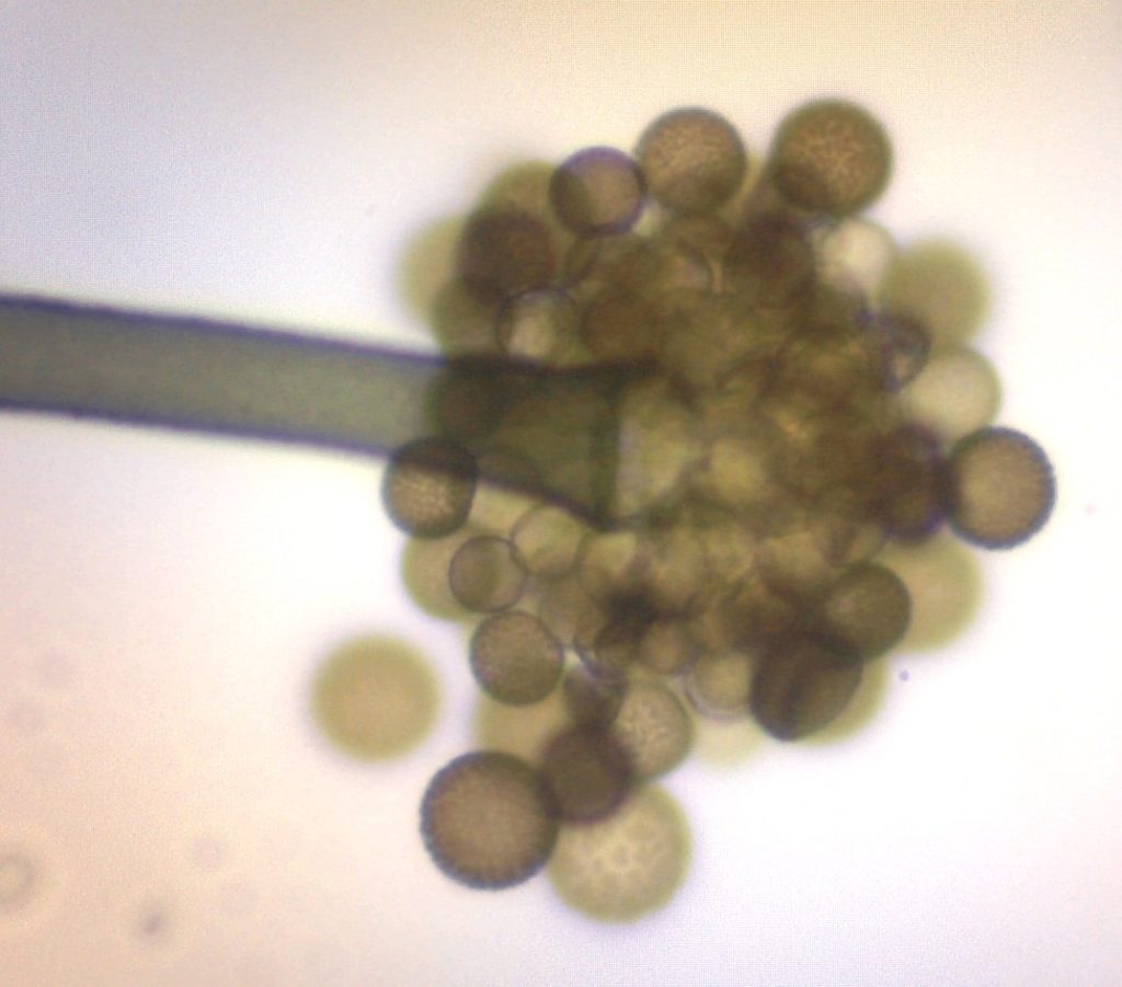 Periconia sp 20-101 c - jpeg.jpg