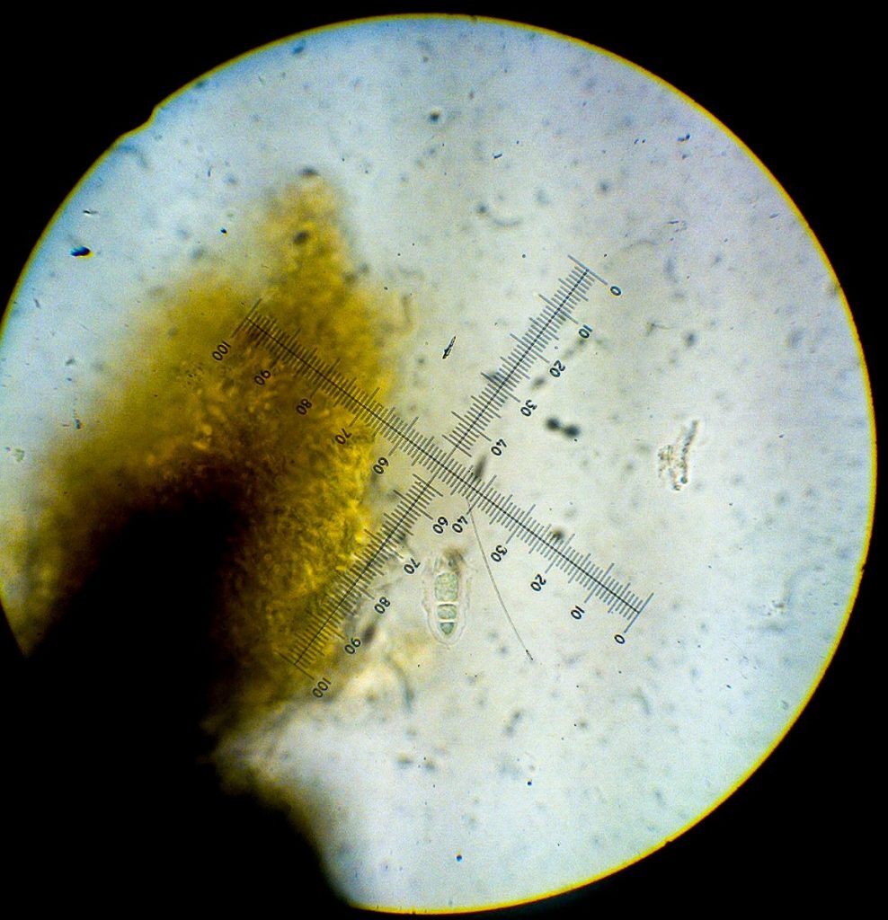 Alyxoria sp. 1-3 (Mrkelig perispore).jpg