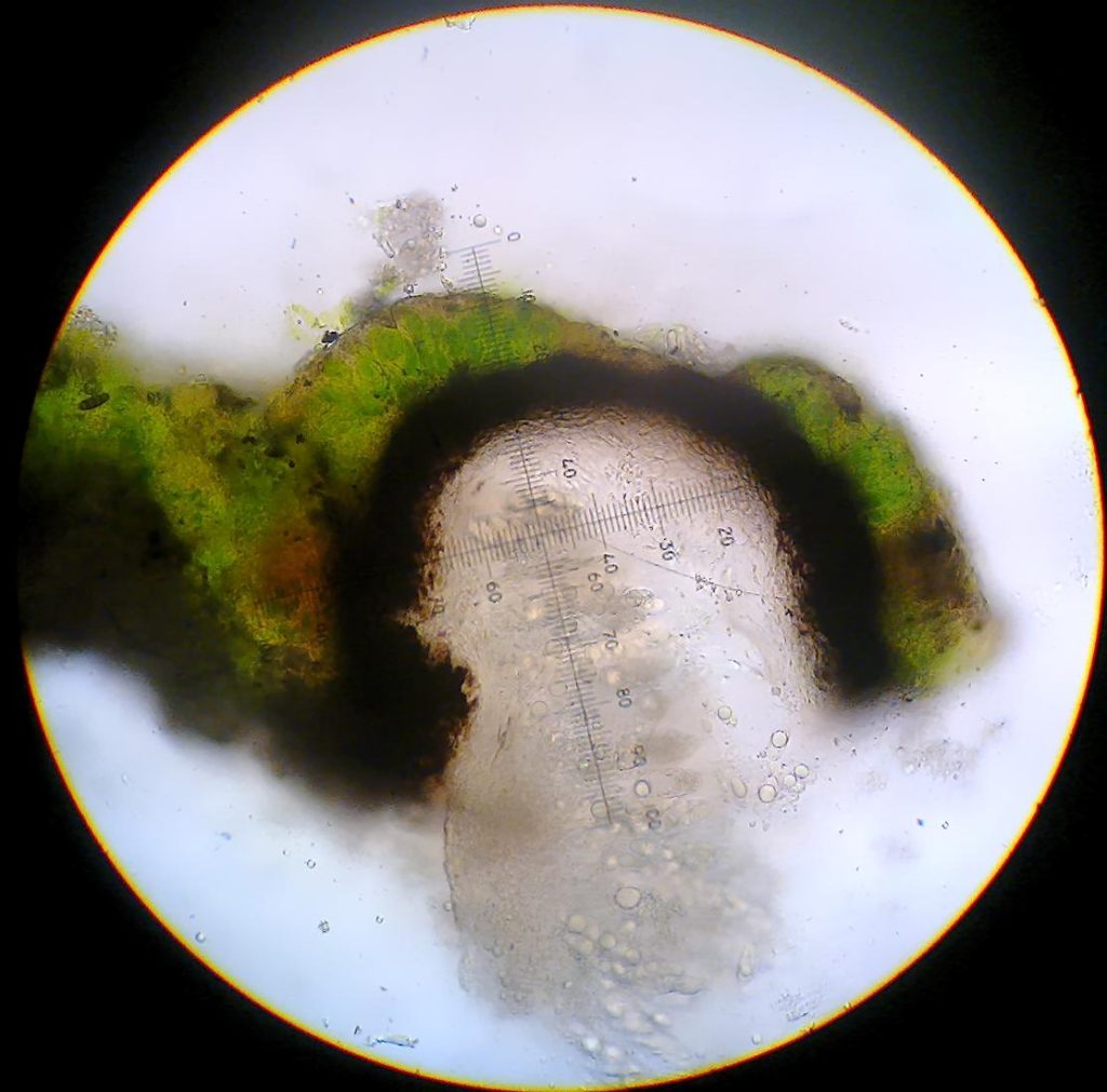 Verrucaria sp. #3 section 2.jpg