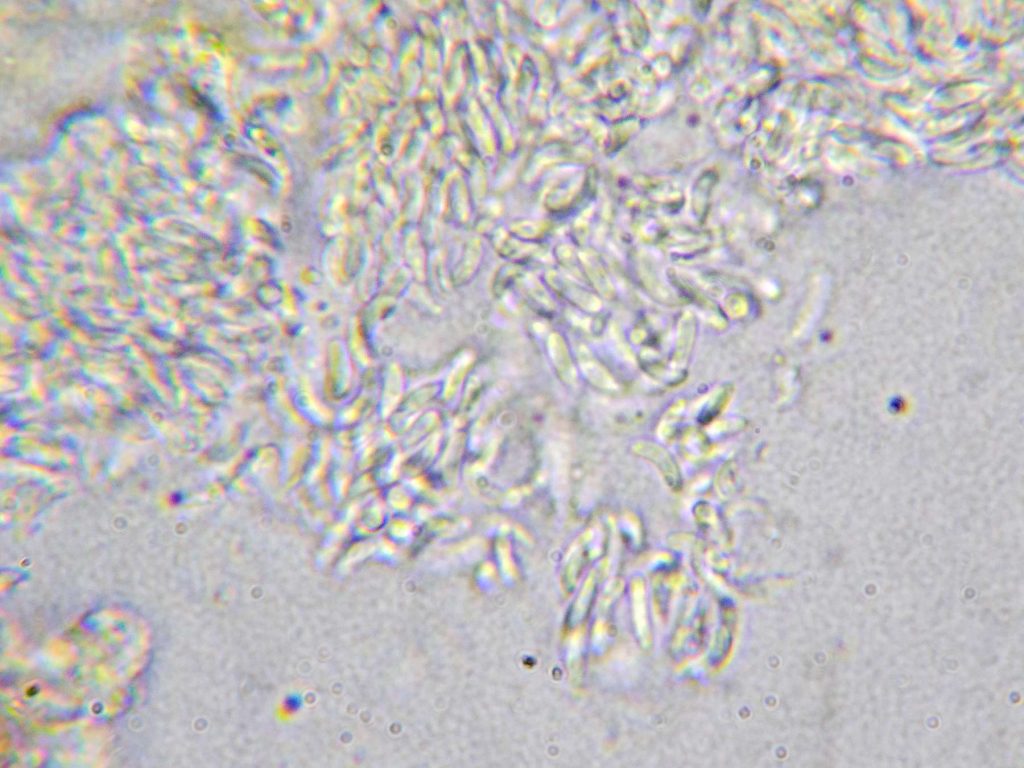 Opegrapha niveoatra 20230408A-12 Bungay.jpg
