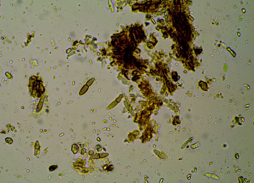 Anisomeridium viridescens Q 240719-9.jpg