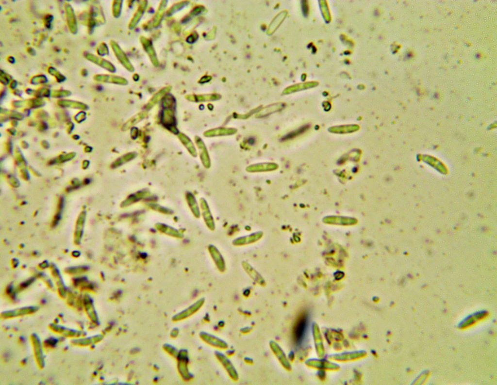 w Anisomeridium viridescens 2 240719-3 con.jpg