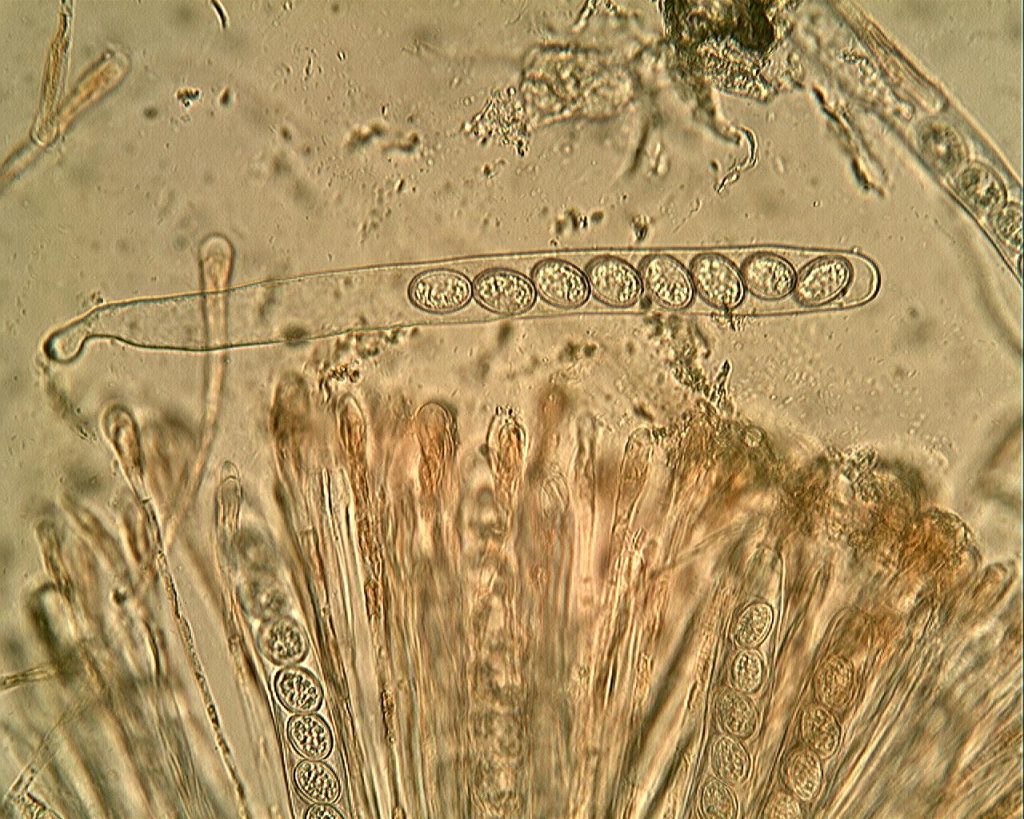 ascus2.jpg
