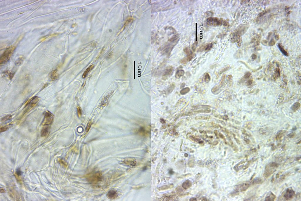 7 Cap cuticle in water 2 - Copy.jpg