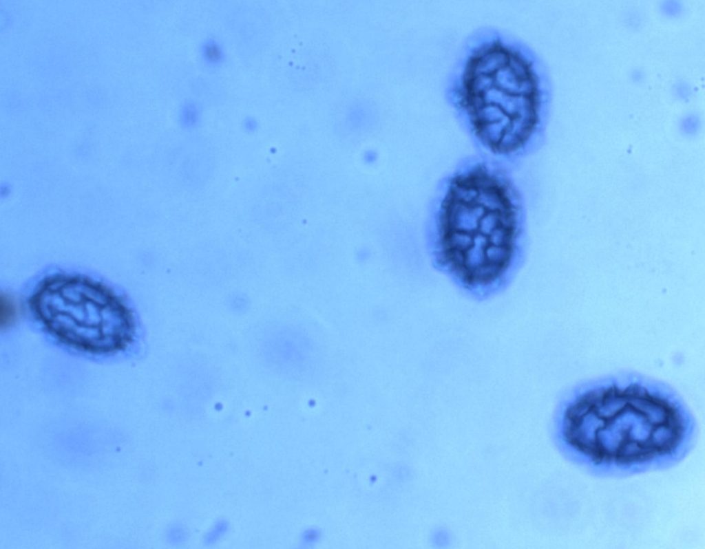 Scutellinia pseudotrechispora spores.jpg