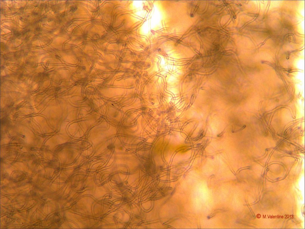 Image06 2013-01-17_Excipular_Hairs_200x.jpg